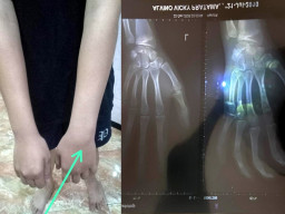 Penyidik Periksa CCTV Dugaan Penganiayaan Oknum Anggota Respati Polrestabes Surabaya
