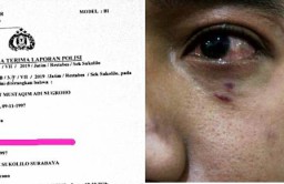 Aktivis PMII Dihajar Orang tak Dikenal