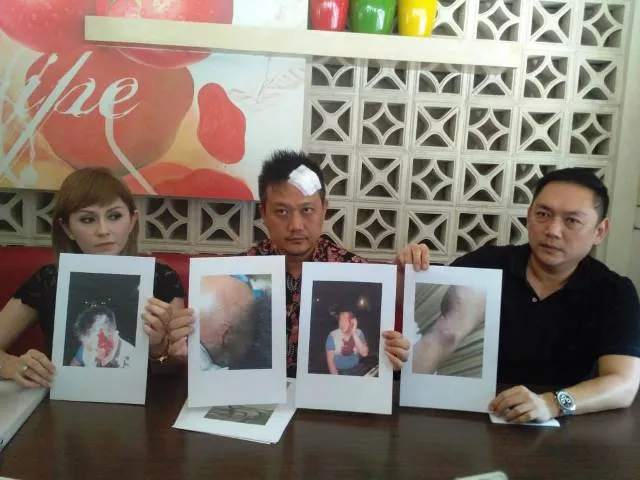 Korban Pengeroyokan Minta Tersangka Perindo Dibui