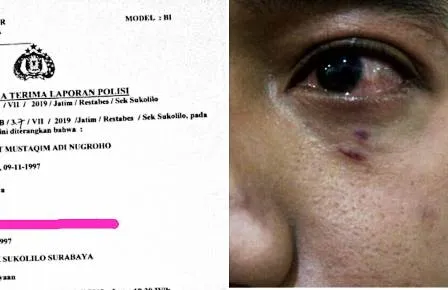 Aktivis PMII Dihajar Orang tak Dikenal