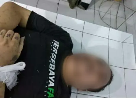 Joner Bonek Meninggal di Rutan Medaeng