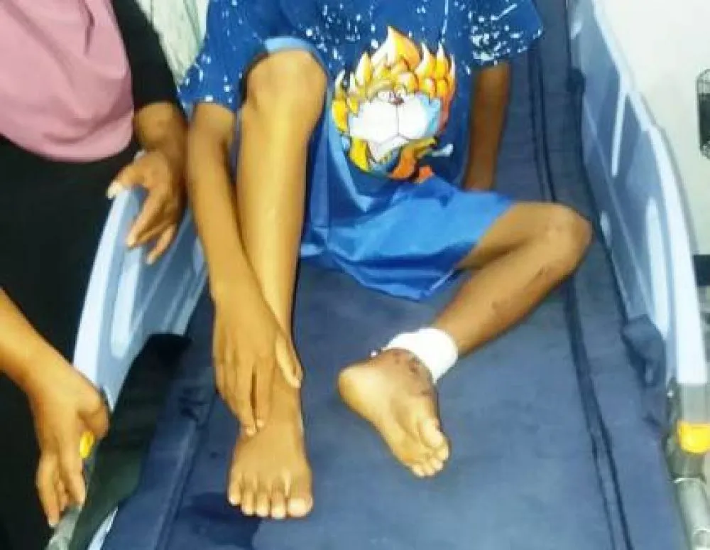 Ada Korban, Pemdes Cuek Jalan Penghubung Rusak