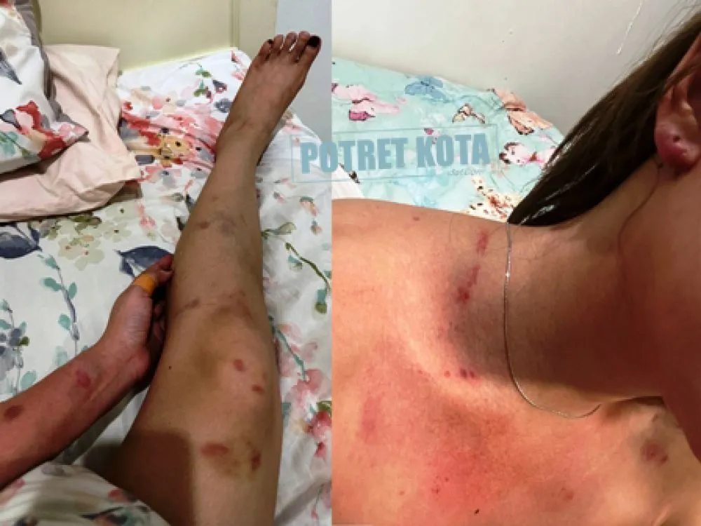 Selebgram Sidoarjo Dihajar Pacarnya Warga Malang
