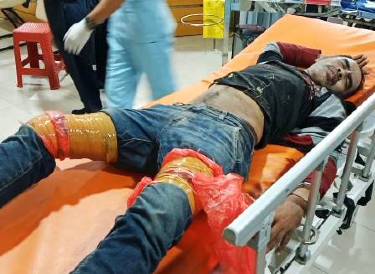 salah satu pelaku curanmor dalam perawatan dokter.