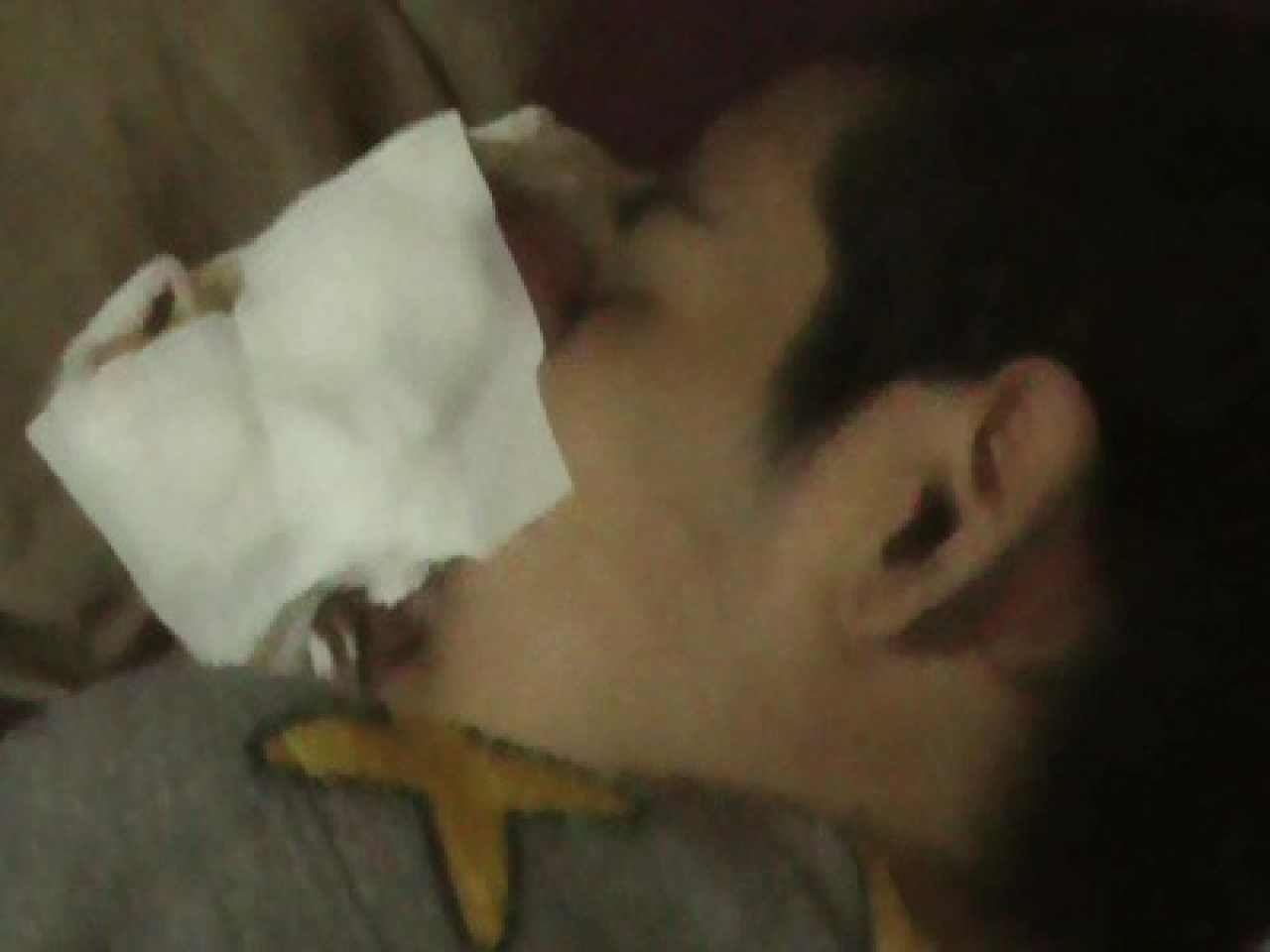 Penderita Tumor Hidung Kembali Ditangani RSUD Dr. Soetomo